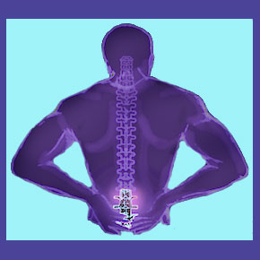 Arthritis in the Lumbar Spine