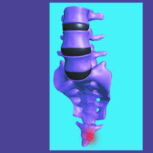 Coccyx Injury
