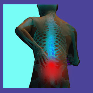 heat or ice for lower back pain