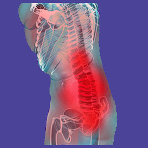 Knowledge therapy for lower back pain