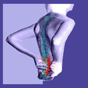 Lower Back Pain from Standing