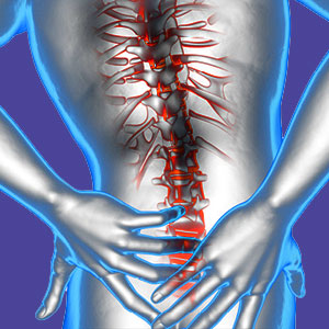 Lower back strain