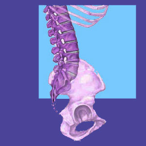 Lumbar bone spurs