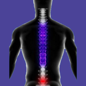lumbar bulging disc