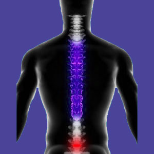 lumbar bulging disc