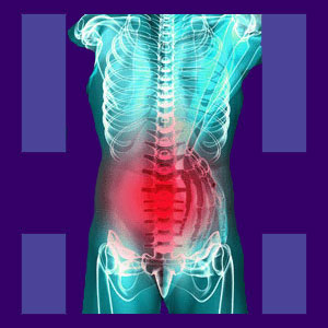 Lumbar degenerative disc disease