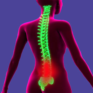 Lumbar spinal stenosis