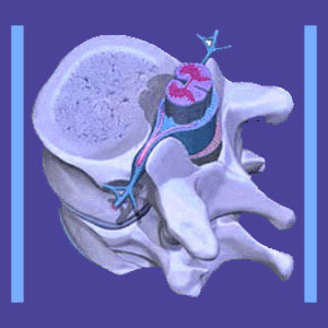 Lumbar spine MRI