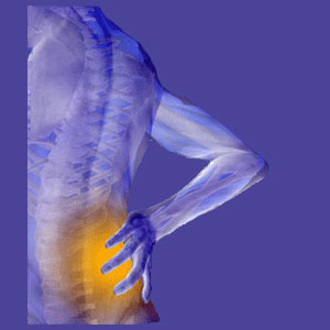 Pinched nerve lower back pain