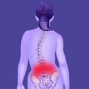 Scoliosis lower back pain