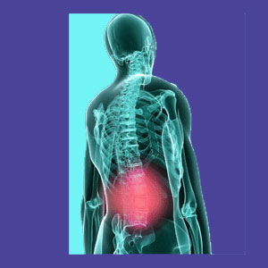 Symptomatic lower back pain treatment